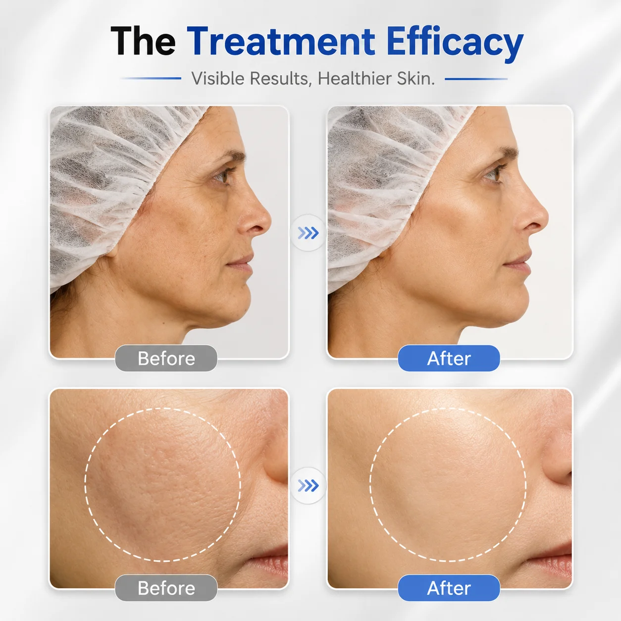 oxygeneo facial machine 3 in 1 before after review